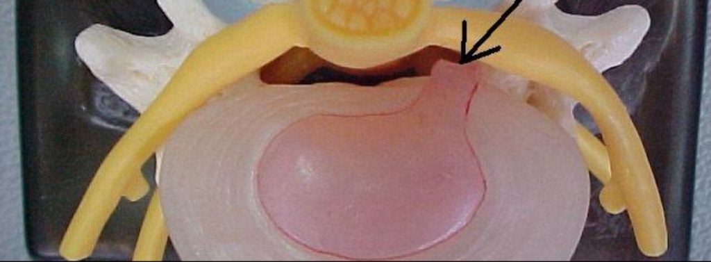 Spaulding Injury Law in Atlanta GA