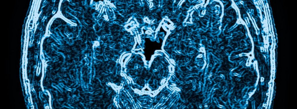 Spaulding Injury Law in Atlanta GA